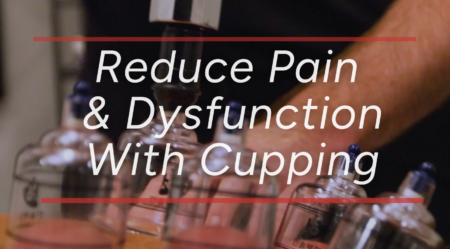 Not Just for Athletes: How Cupping Supports Everyday Recovery